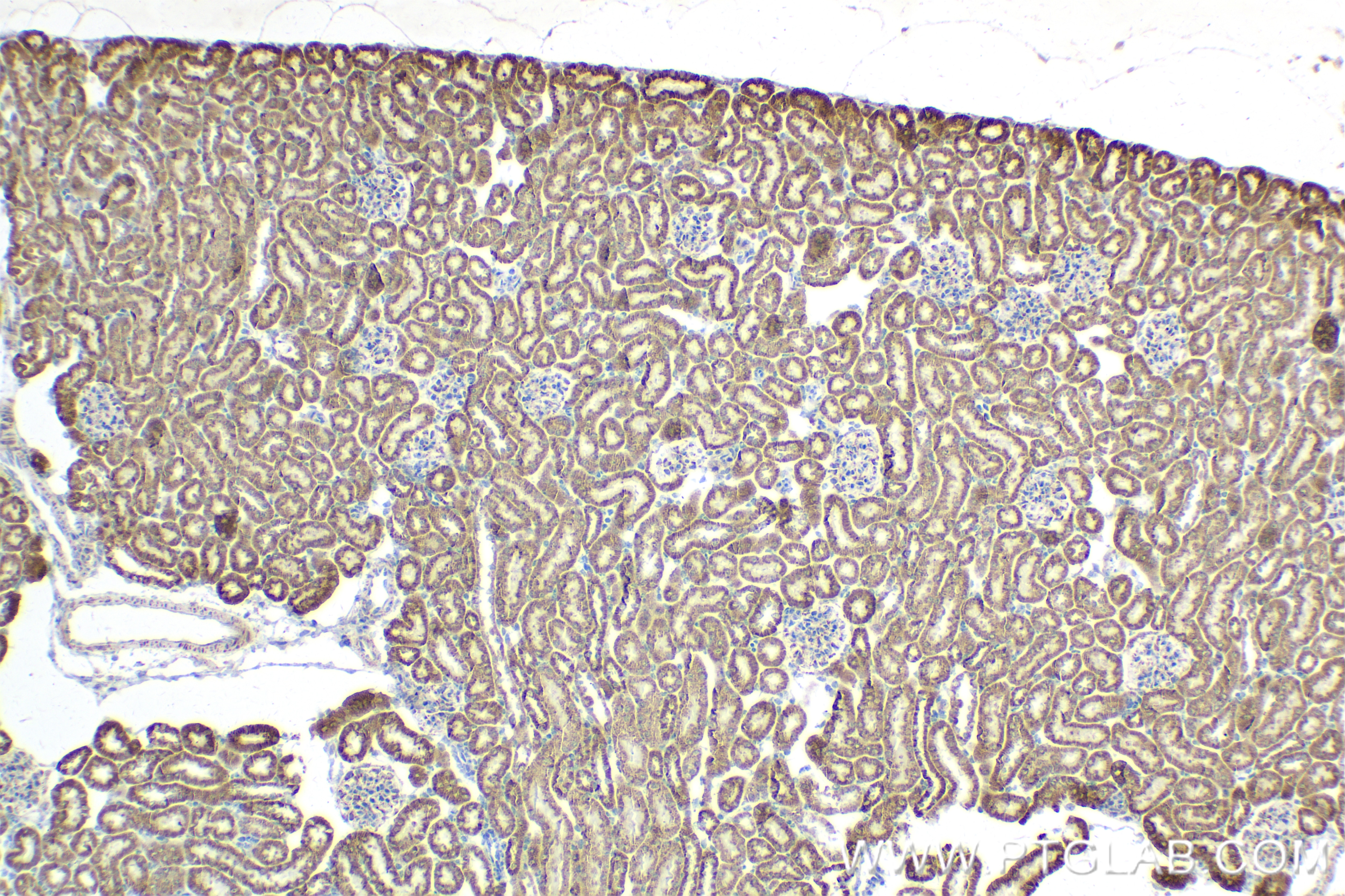 Immunohistochemistry (IHC) staining of mouse kidney tissue using PDK4 Recombinant antibody (83583-1-RR)