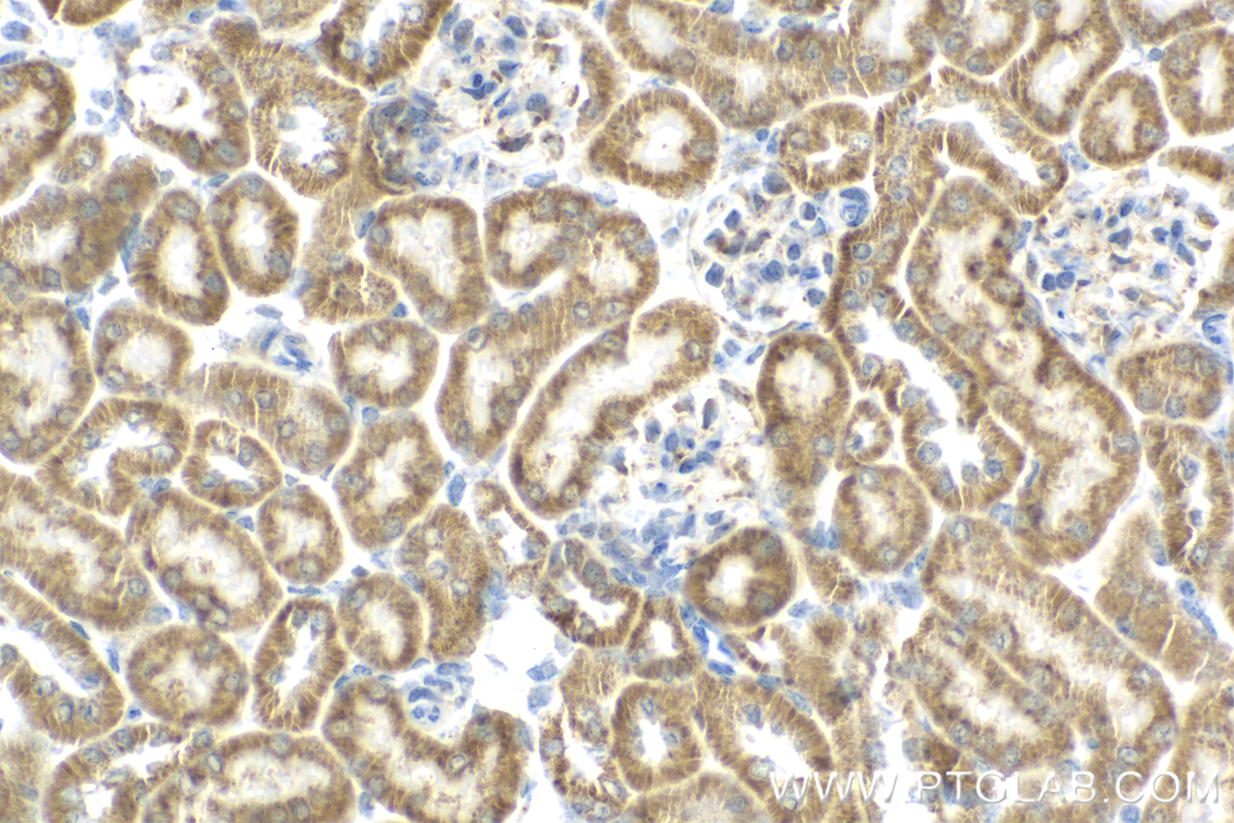 Immunohistochemistry (IHC) staining of mouse kidney tissue using PDK4 Recombinant antibody (83583-1-RR)