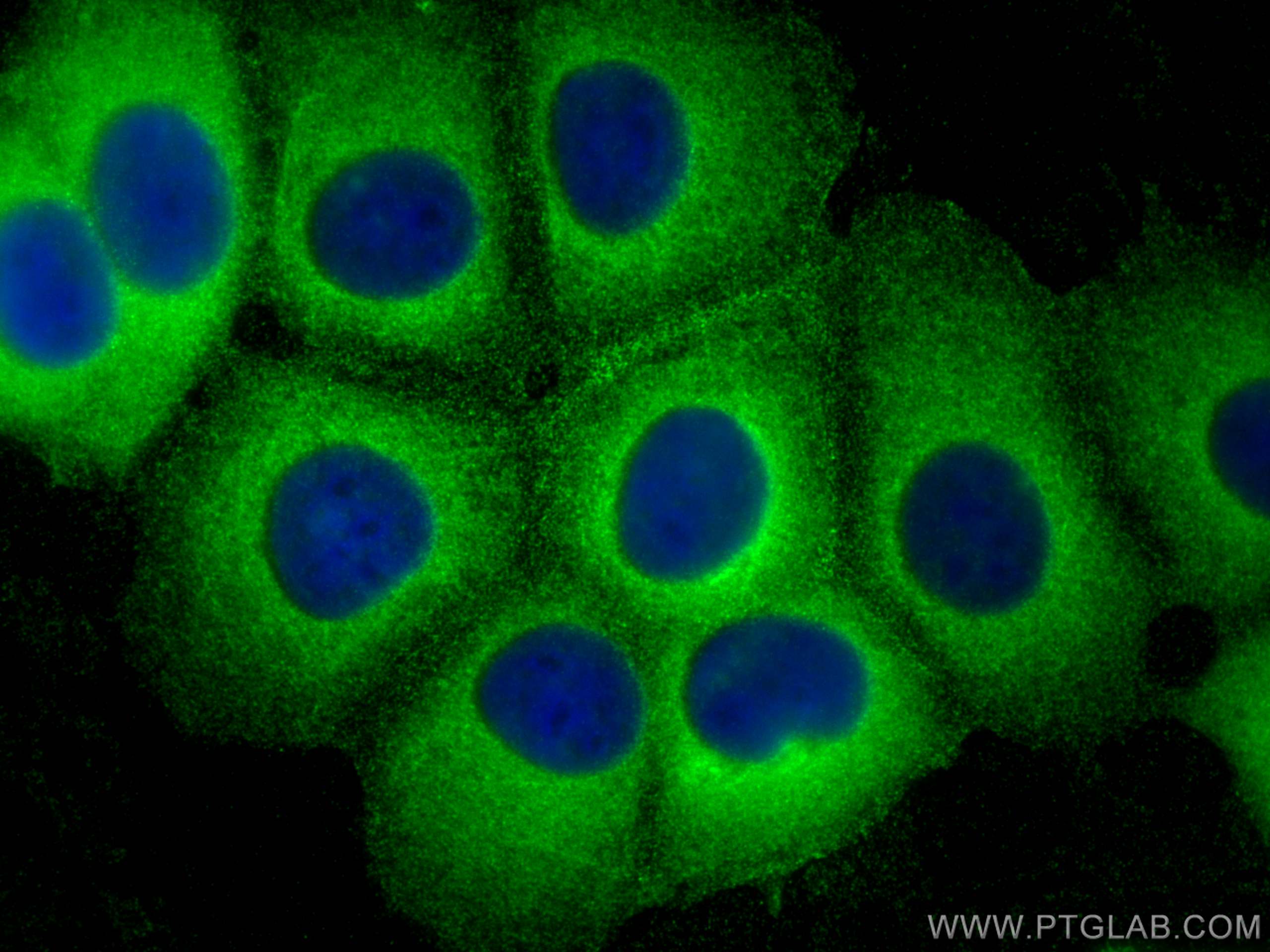 Immunofluorescence (IF) / fluorescent staining of MCF-7 cells using PDLIM1/CLP36 Polyclonal antibody (11674-1-AP)