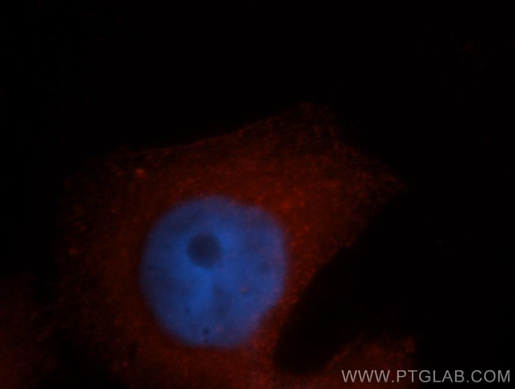 Immunofluorescence (IF) / fluorescent staining of MCF-7 cells using PDLIM1/CLP36 Polyclonal antibody (11674-1-AP)