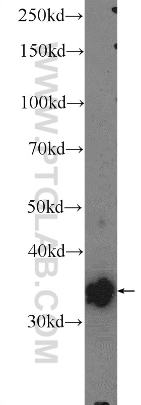 Western Blot (WB) analysis of mouse heart tissue using PDLIM1/CLP36 Polyclonal antibody (11674-1-AP)