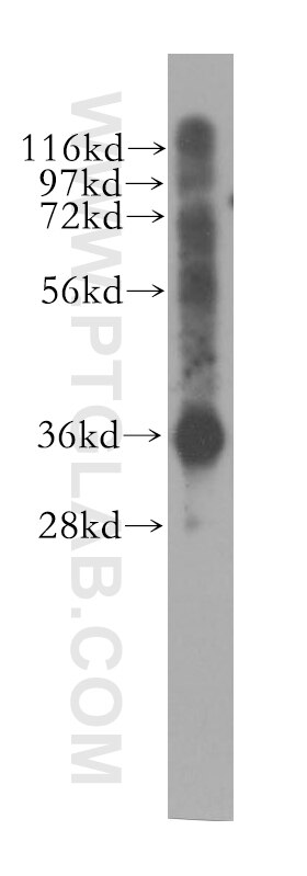 Western Blot (WB) analysis of human lung tissue using PDLIM1/CLP36 Polyclonal antibody (11674-1-AP)