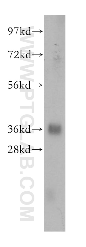 Western Blot (WB) analysis of human ileum tissue using PDLIM1/CLP36 Polyclonal antibody (11674-1-AP)