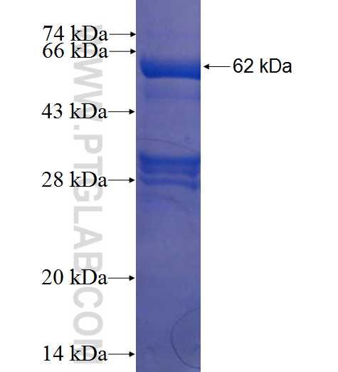 PDLIM1,CLP36 fusion protein Ag2274 SDS-PAGE