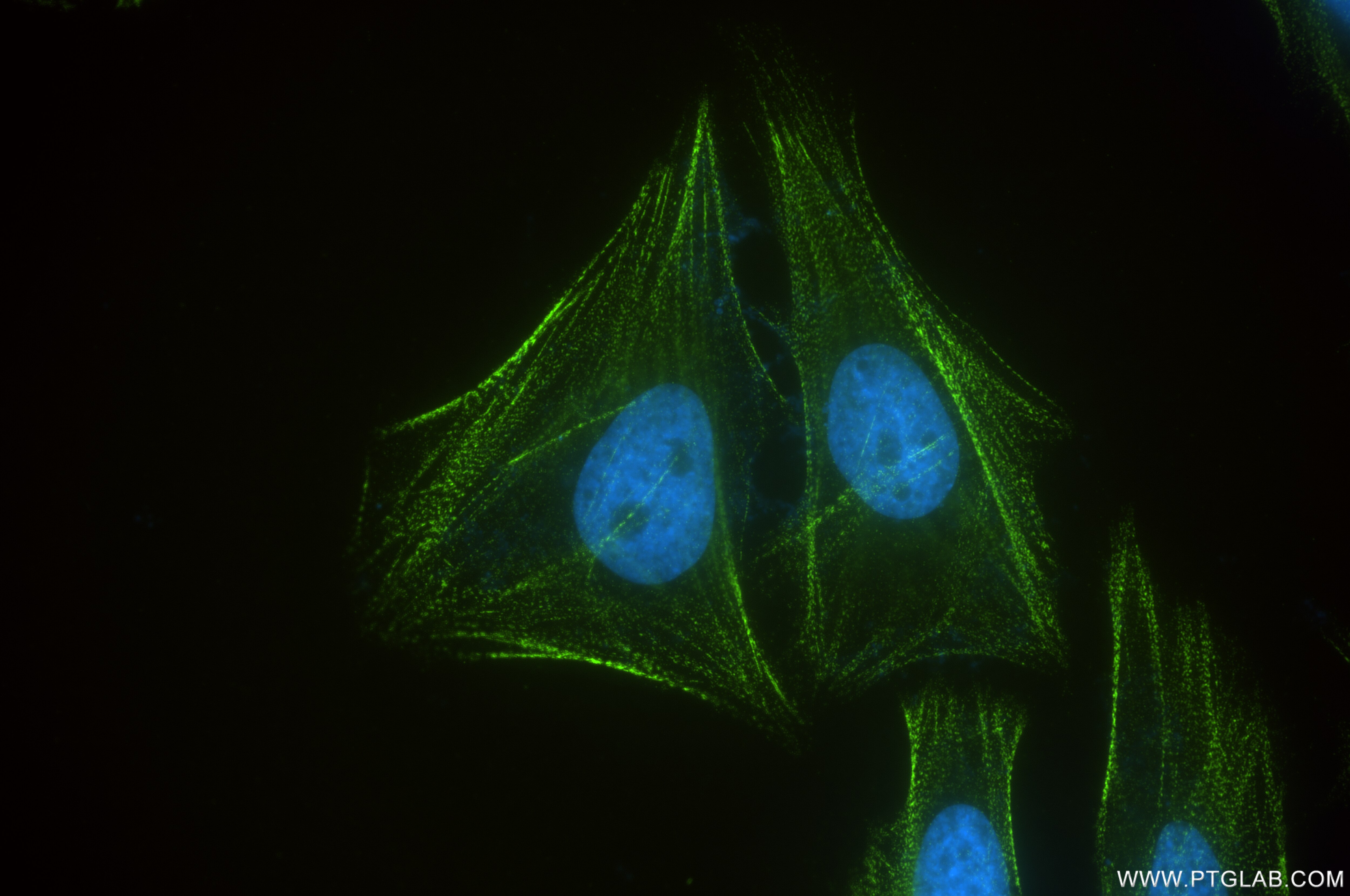 Immunofluorescence (IF) / fluorescent staining of HeLa cells using PDLIM1/CLP36 Recombinant antibody (85027-5-RR)