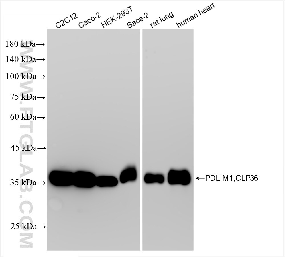 Western Blot (WB) analysis of various lysates using PDLIM1/CLP36 Recombinant antibody (85027-5-RR)
