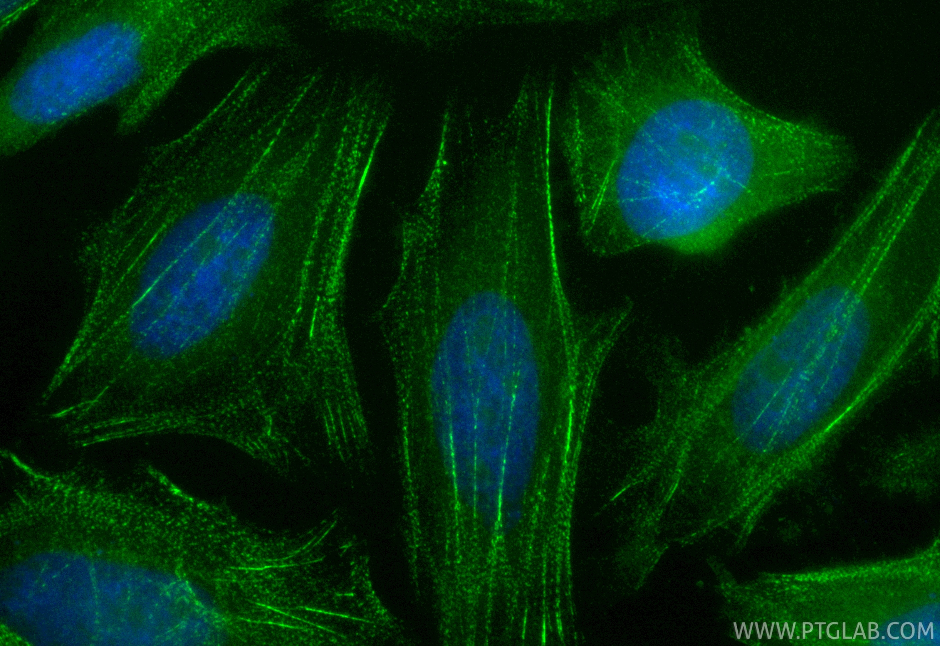 Immunofluorescence (IF) / fluorescent staining of HeLa cells using CoraLite® Plus 488-conjugated PDLIM1/CLP36 Recombi (CL488-85027-5)