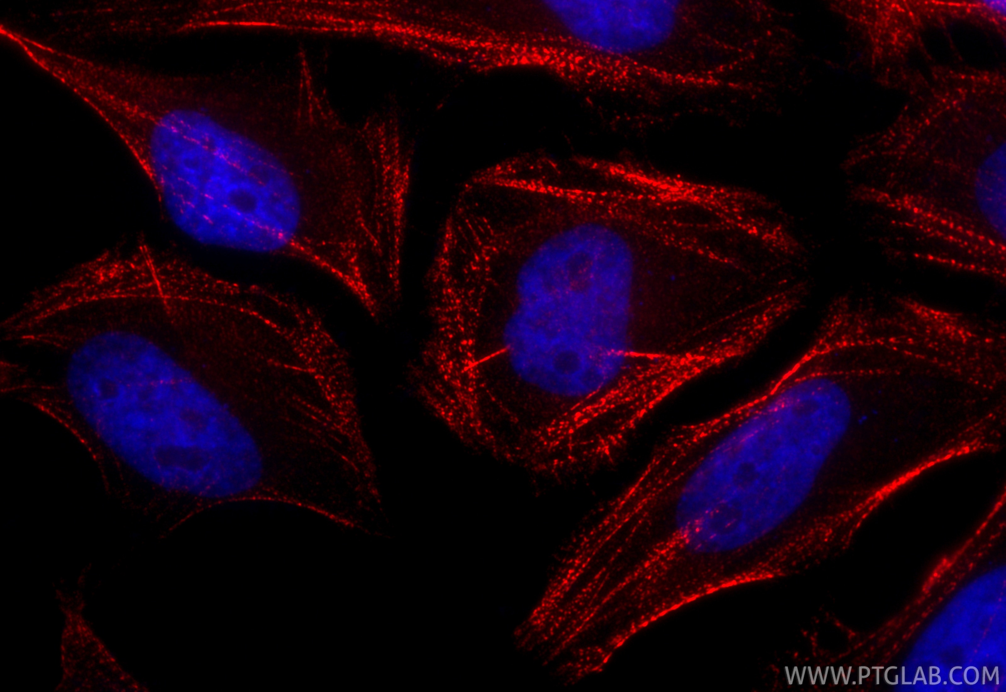 Immunofluorescence (IF) / fluorescent staining of HeLa cells using CoraLite®594-conjugated PDLIM1/CLP36 Recombinant a (CL594-85027-5)