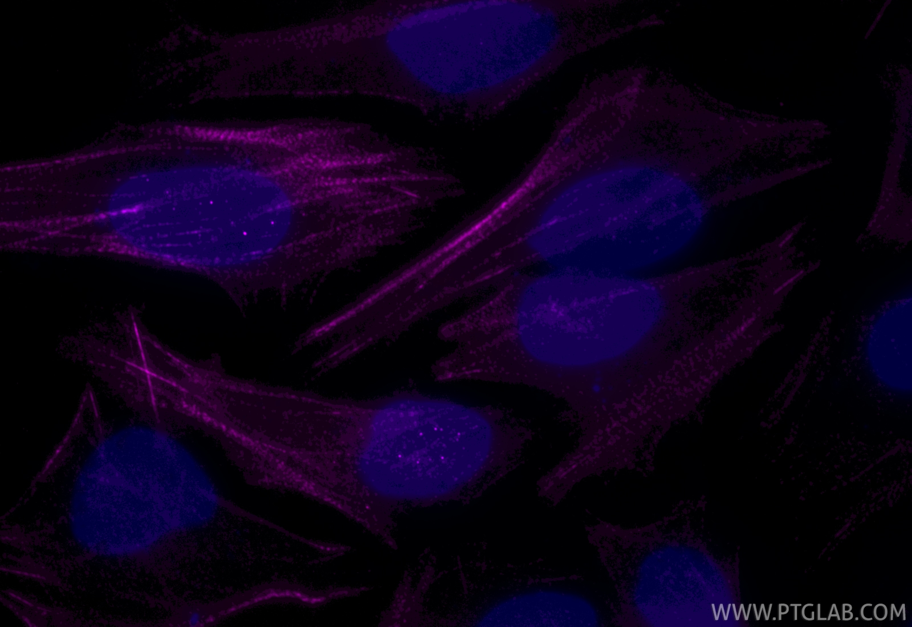 Immunofluorescence (IF) / fluorescent staining of HeLa cells using CoraLite® Plus 647-conjugated PDLIM1/CLP36 Recombi (CL647-85027-5)