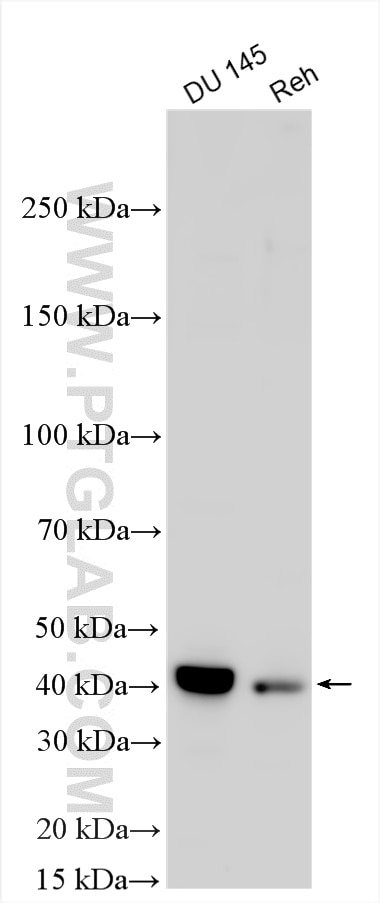 WB analysis using 11574-1-AP Western Blot (WB) analysis of various lysates using PDLIM2 Polyclonal antibody (11574-1-AP)