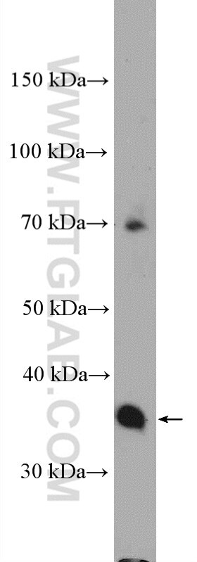 Western Blot (WB) analysis of mouse spleen tissue using PDLIM3 Polyclonal antibody (13199-2-AP)