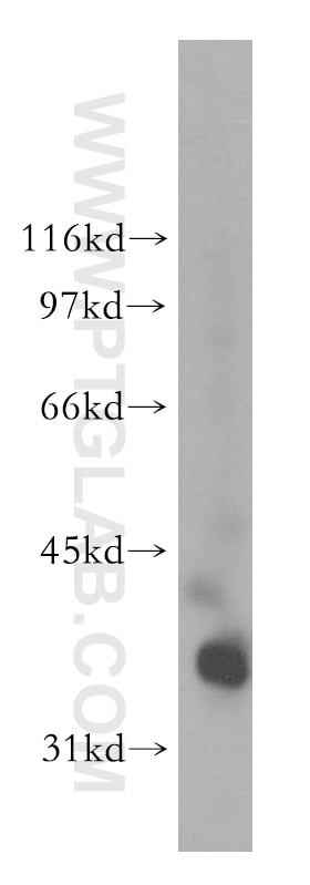 Western Blot (WB) analysis of human heart tissue using PDLIM3 Polyclonal antibody (13199-2-AP)