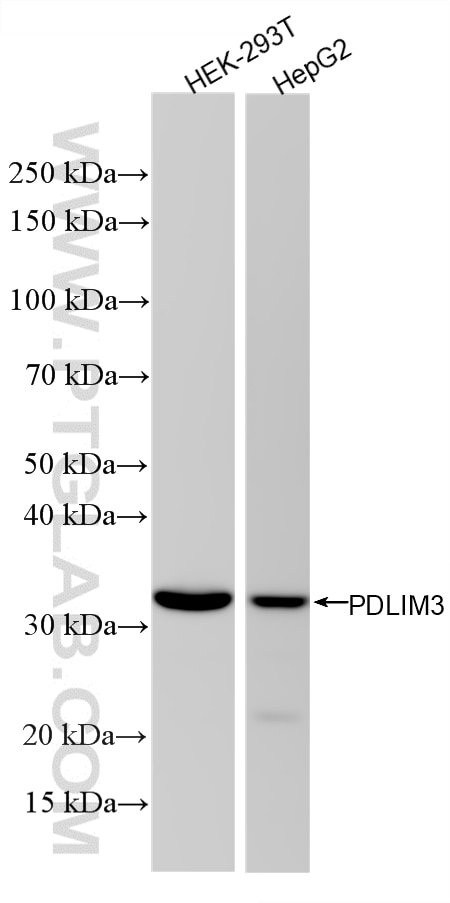 Western Blot (WB) analysis of various lysates using PDLIM3 Recombinant monoclonal antibody (87058-2-RR)