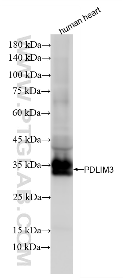 Western Blot (WB) analysis of human heart tissue using PDLIM3 Recombinant monoclonal antibody (87058-2-RR)