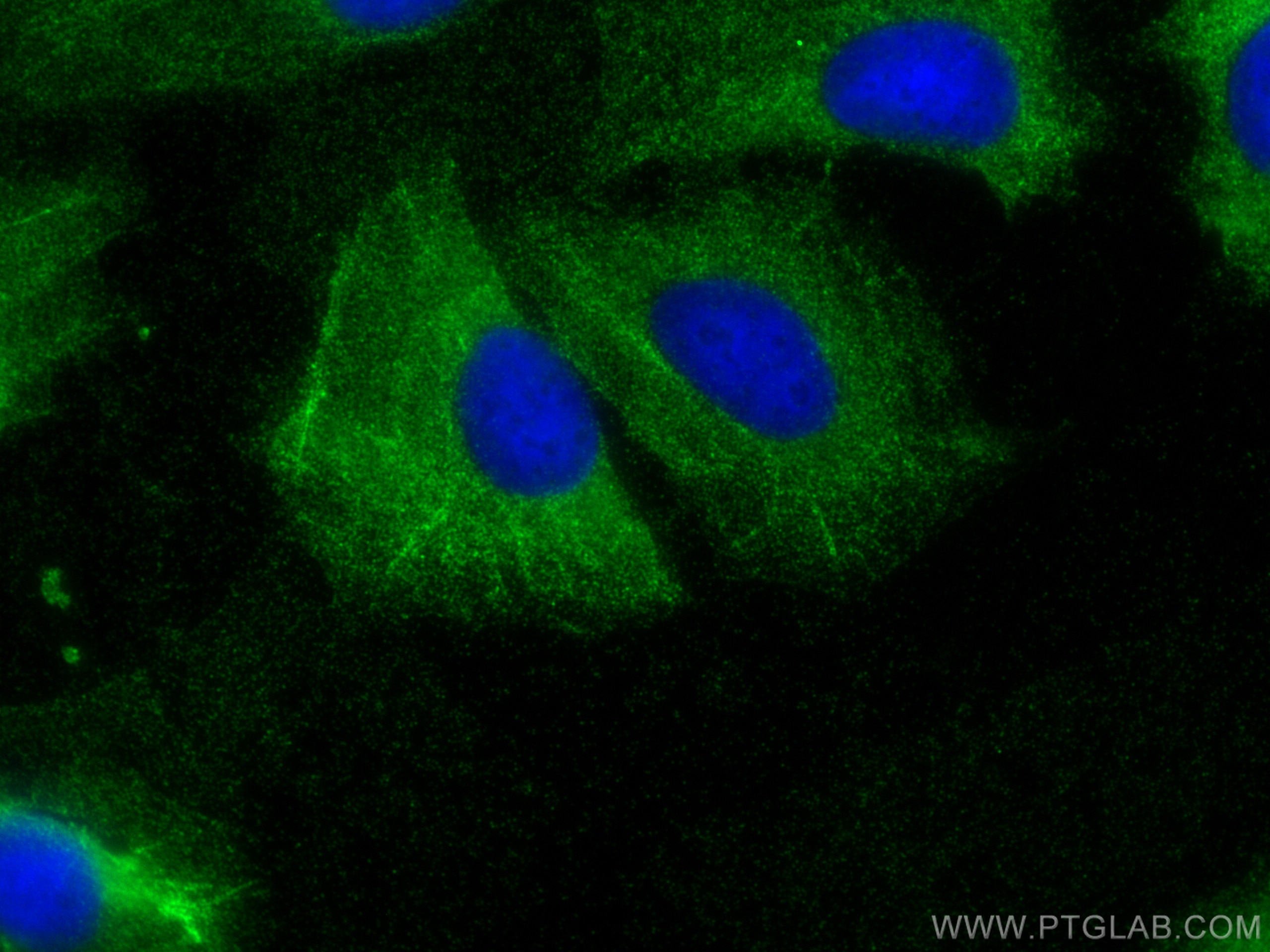 Immunofluorescence (IF) / fluorescent staining of U2OS cells using PDLIM4 Polyclonal antibody (18543-1-AP)