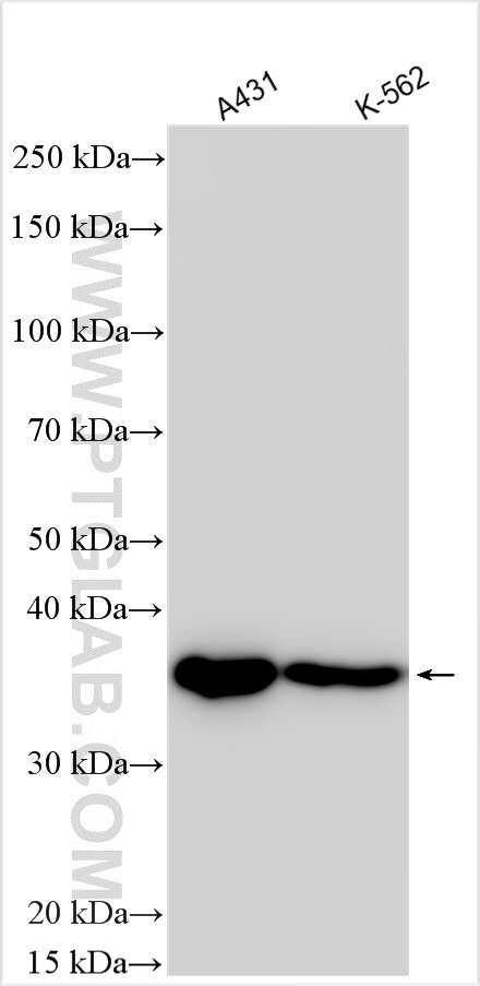 Western Blot (WB) analysis of various lysates using PDLIM4 Polyclonal antibody (18543-1-AP)