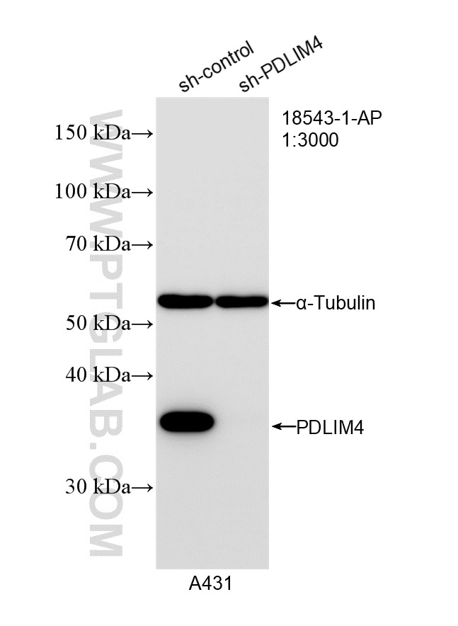 WB result of PDLIM4 antibody (18543-1-AP; 1:3000; incubated at room temperature for 1.5 hours) with sh-Control and sh-PDLIM4 transfected A431 cells. Western Blot (WB) analysis of A431 cells using PDLIM4 Polyclonal antibody (18543-1-AP)
