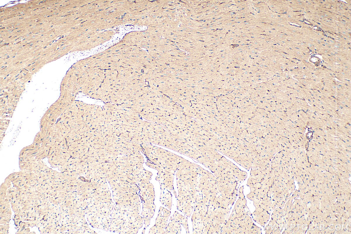 Immunohistochemistry (IHC) staining of mouse heart tissue using PDLIM5 Polyclonal antibody (10530-1-AP)