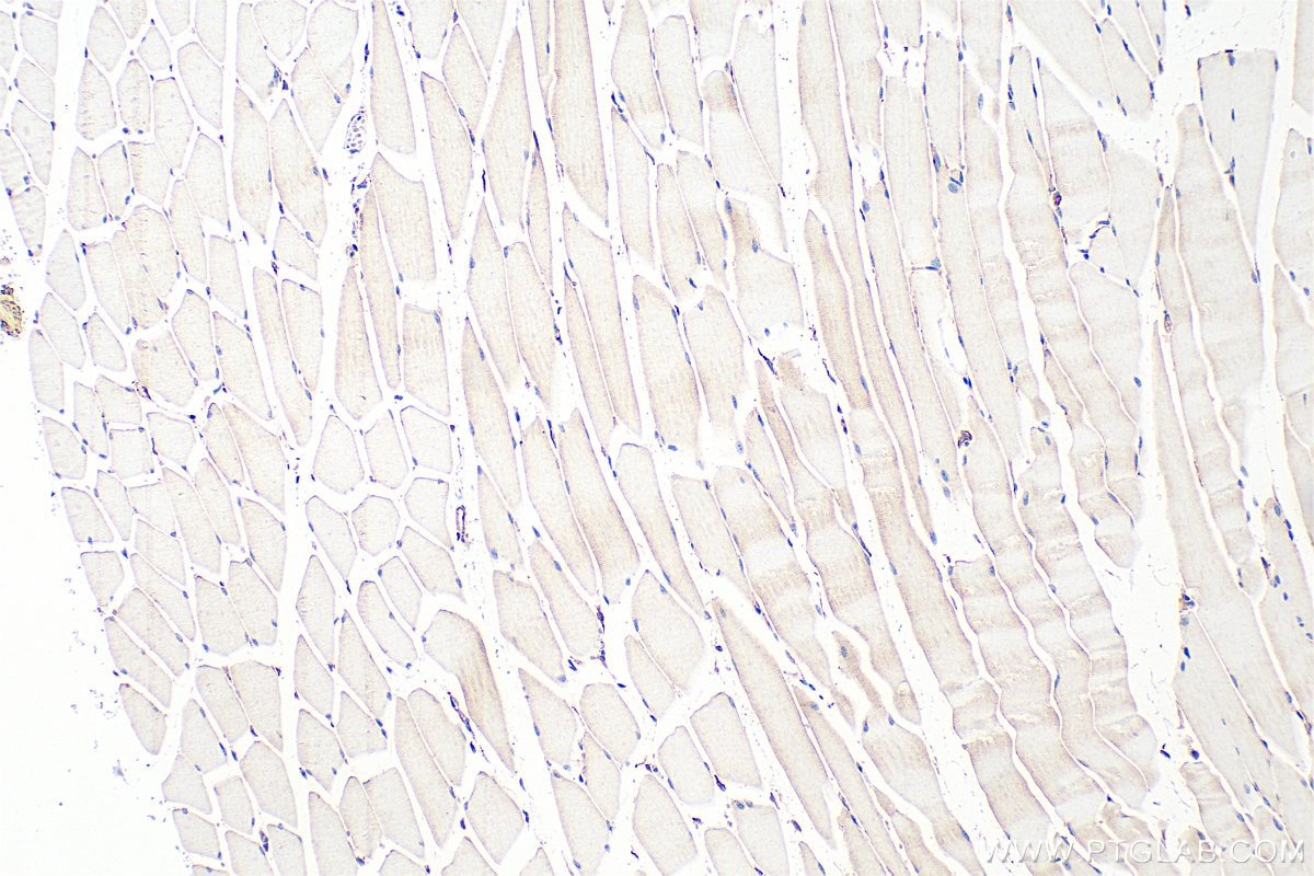 Immunohistochemistry (IHC) staining of mouse skeletal muscle tissue using PDLIM5 Polyclonal antibody (10530-1-AP)