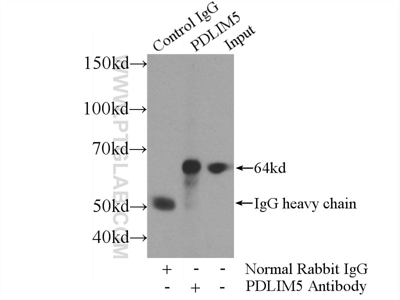 Immunoprecipitation (IP) experiment of A549 cells using PDLIM5 Polyclonal antibody (10530-1-AP)