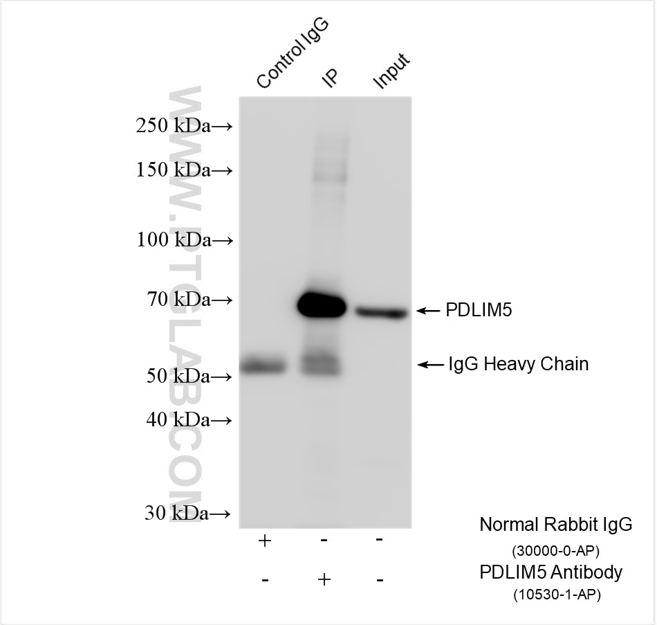 Immunoprecipitation (IP) experiment of HeLa cells using PDLIM5 Polyclonal antibody (10530-1-AP)