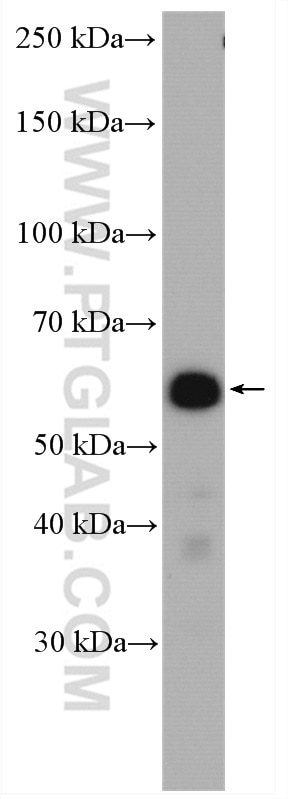Western Blot (WB) analysis of HUVEC cells using PDLIM5 Polyclonal antibody (10530-1-AP)