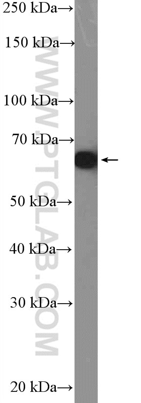 Western Blot (WB) analysis of A549 cells using PDLIM5 Polyclonal antibody (10530-1-AP)