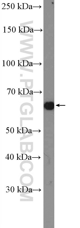 Western Blot (WB) analysis of HeLa cells using PDLIM5 Polyclonal antibody (10530-1-AP)