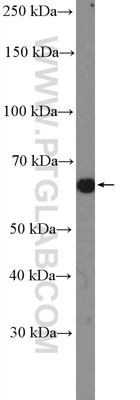 Western Blot (WB) analysis of HeLa cells using PDLIM5 Polyclonal antibody (10530-1-AP)