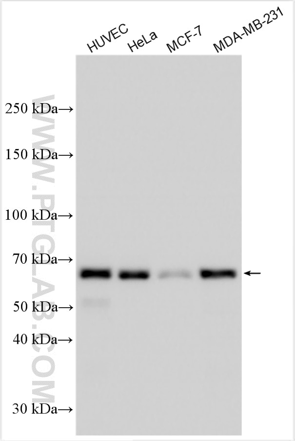 Western Blot (WB) analysis of various lysates using PDLIM5 Polyclonal antibody (10530-1-AP)