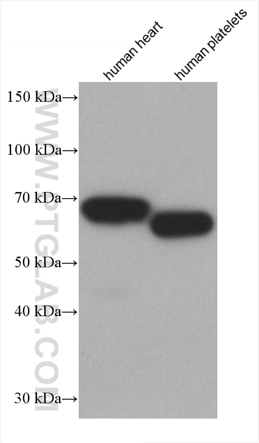 Western Blot (WB) analysis of various lysates using PDLIM5 Monoclonal antibody (67651-1-Ig)