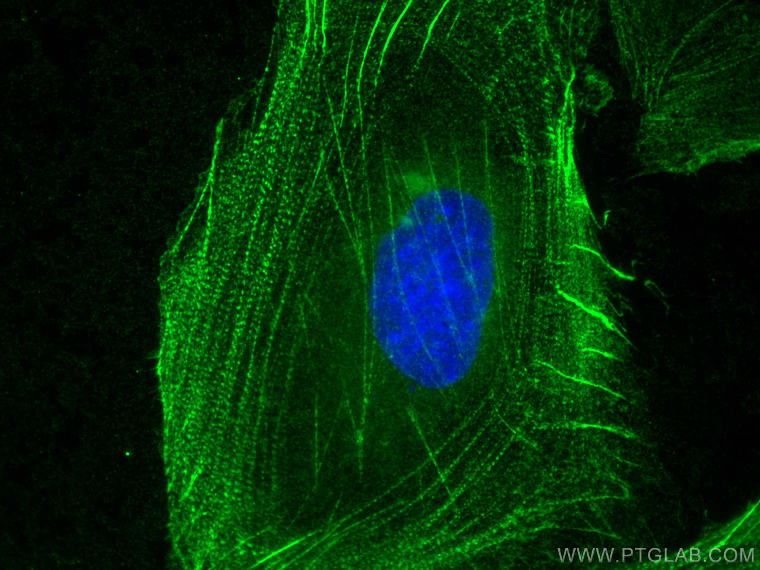 Immunofluorescence (IF) / fluorescent staining of SKOV-3 cells using PDLIM7 Polyclonal antibody (10221-1-AP)