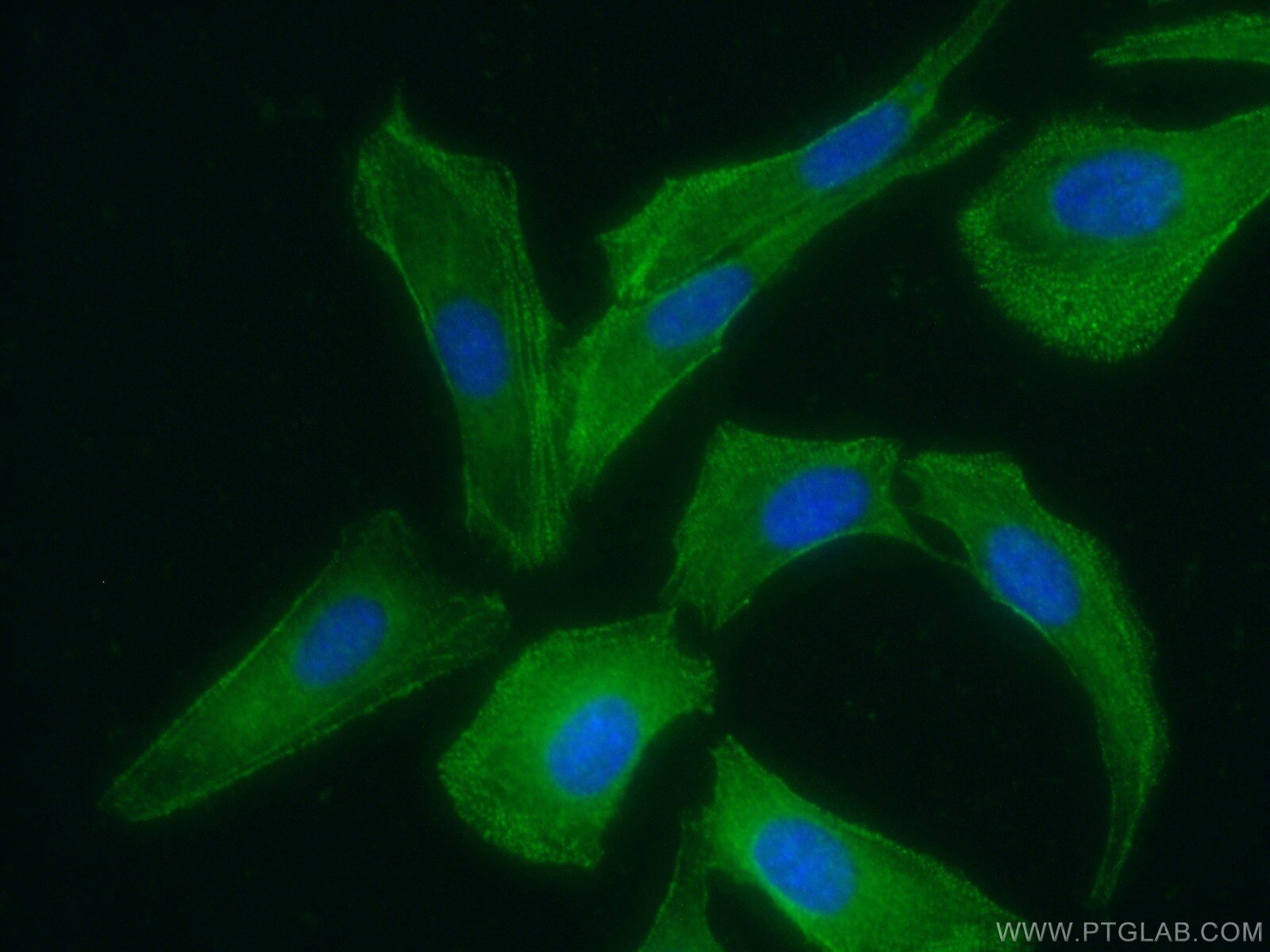 Immunofluorescence (IF) / fluorescent staining of SKOV-3 cells using PDLIM7 Polyclonal antibody (10221-1-AP)