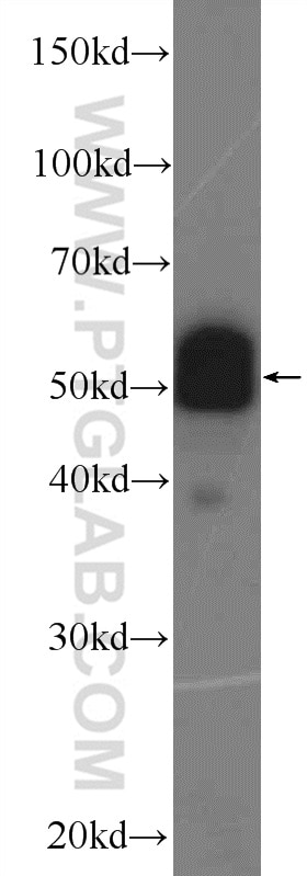 Western Blot (WB) analysis of MCF-7 cells using PDLIM7 Polyclonal antibody (10221-1-AP)