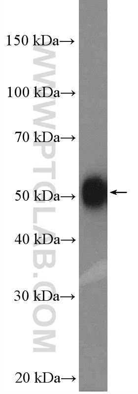 Western Blot (WB) analysis of SKOV-3 cells using PDLIM7 Polyclonal antibody (10221-1-AP)