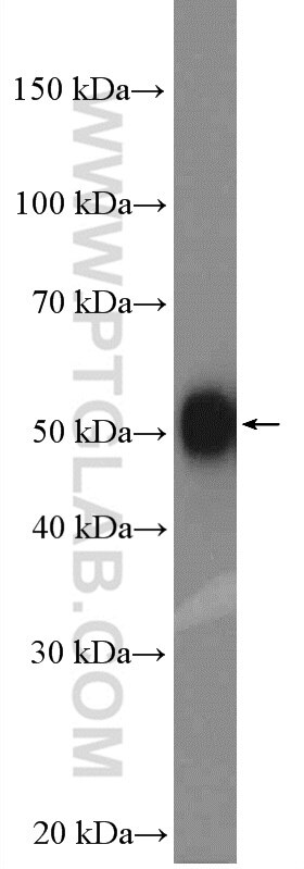 WB analysis of SKOV-3 using 10221-1-AP