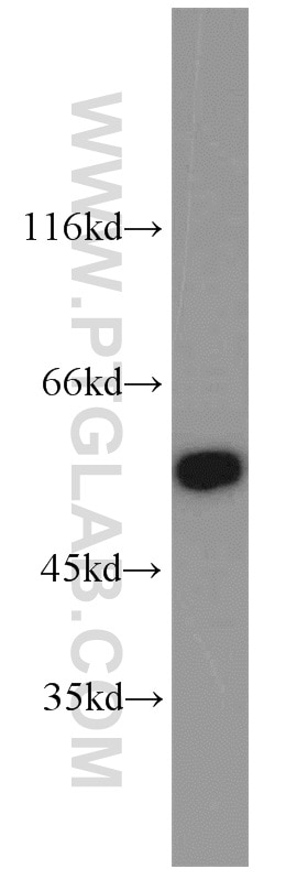 Western Blot (WB) analysis of SKOV-3 cells using PDLIM7 Polyclonal antibody (10221-1-AP)