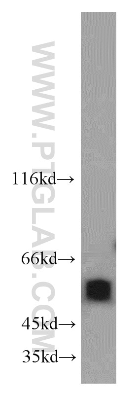 Western Blot (WB) analysis of HeLa cells using PDLIM7 Polyclonal antibody (10221-1-AP)