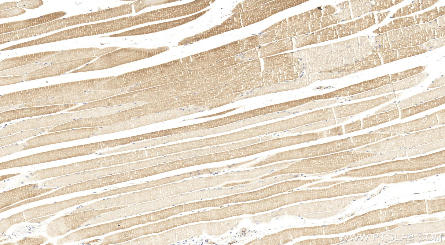 Immunohistochemistry (IHC) staining of mouse skeletal muscle tissue using PDLIM7 Polyclonal antibody (17080-1-AP)