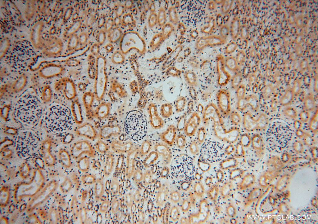 Immunohistochemistry (IHC) staining of human kidney tissue using PDLIM7 Polyclonal antibody (17080-1-AP)