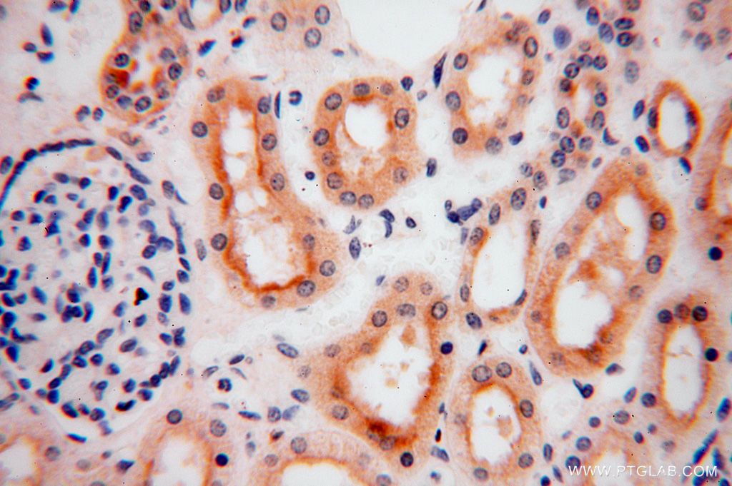 Immunohistochemistry (IHC) staining of human kidney tissue using PDLIM7 Polyclonal antibody (17080-1-AP)