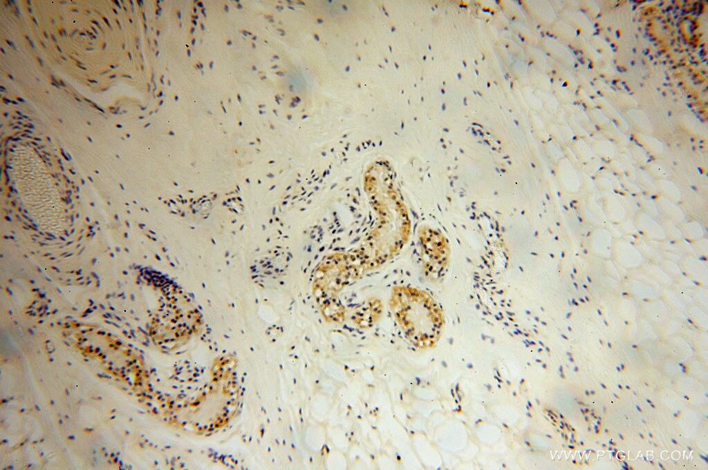 Immunohistochemistry (IHC) staining of human skin tissue using PDLIM7 Polyclonal antibody (17080-1-AP)