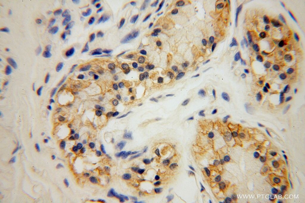 Immunohistochemistry (IHC) staining of human skin tissue using PDLIM7 Polyclonal antibody (17080-1-AP)