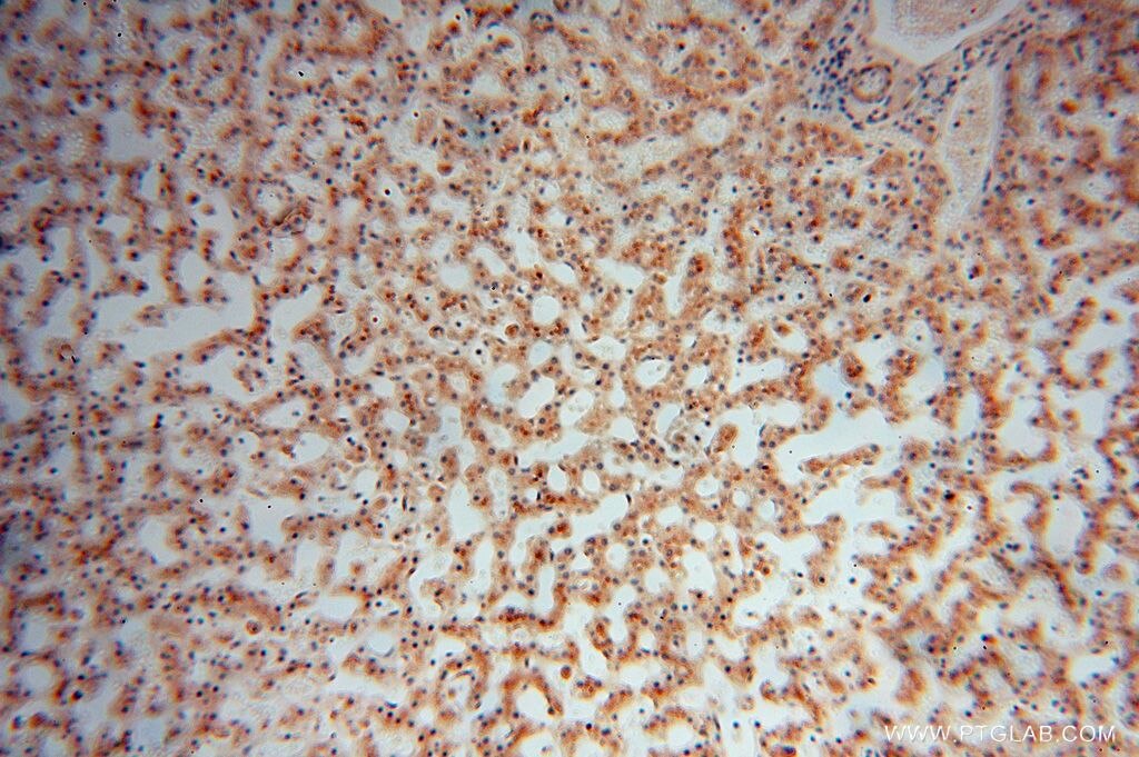 Immunohistochemistry (IHC) staining of human liver tissue using PDLIM7 Polyclonal antibody (17080-1-AP)