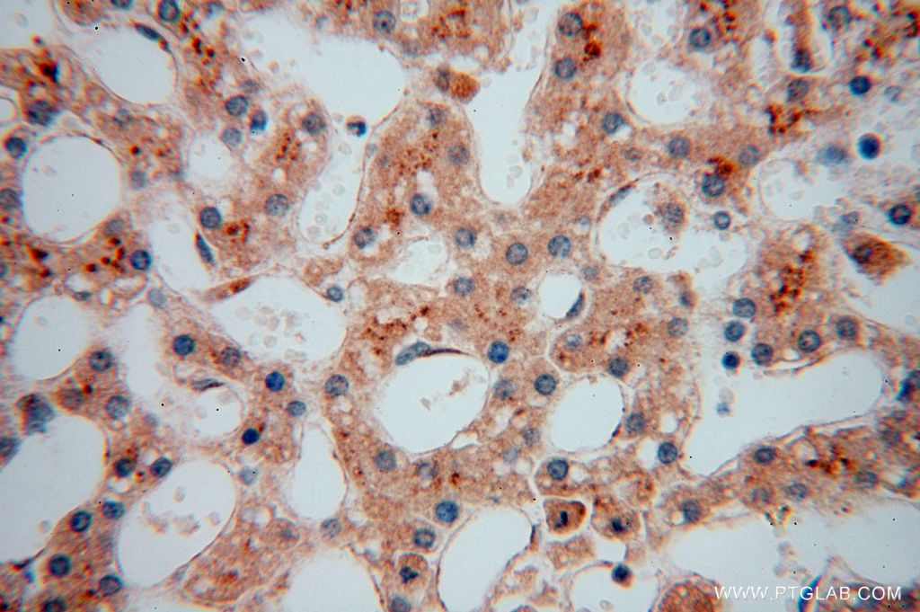 Immunohistochemistry (IHC) staining of human liver tissue using PDLIM7 Polyclonal antibody (17080-1-AP)