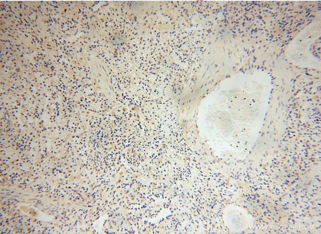 Immunohistochemistry (IHC) staining of human spleen tissue using PDLIM7 Polyclonal antibody (17080-1-AP)