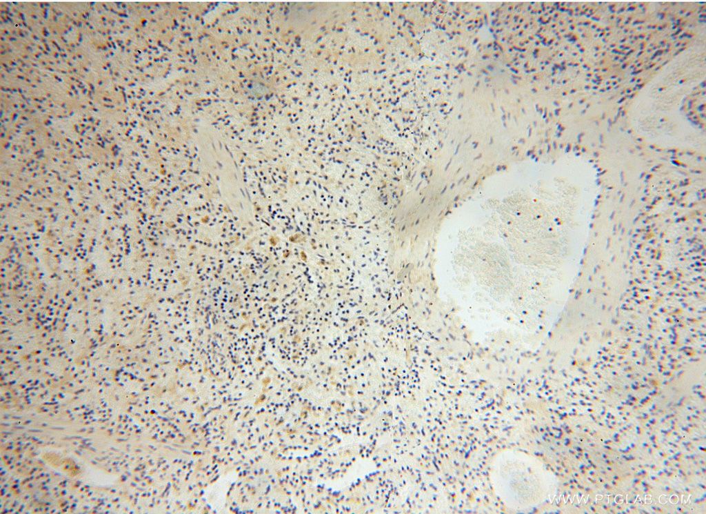 IHC staining of human spleen using 17080-1-AP