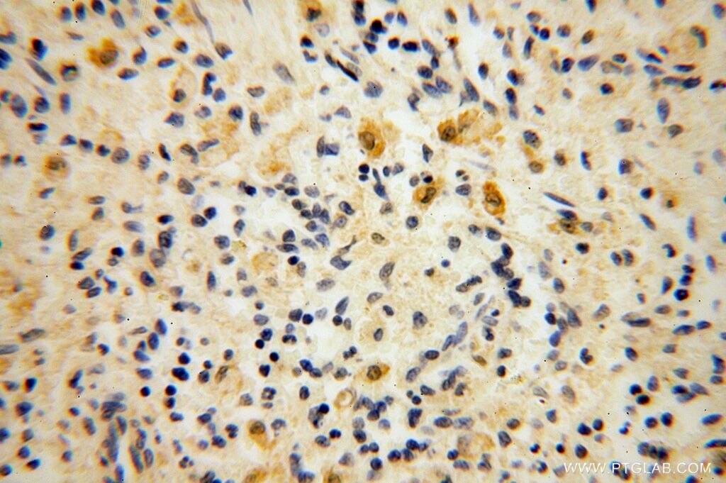 Immunohistochemistry (IHC) staining of human spleen tissue using PDLIM7 Polyclonal antibody (17080-1-AP)