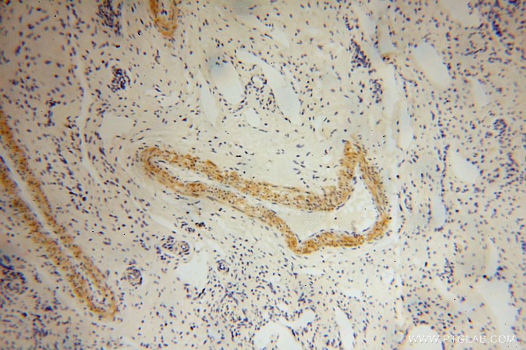 Immunohistochemistry (IHC) staining of human ovary tissue using PDLIM7 Polyclonal antibody (17080-1-AP)