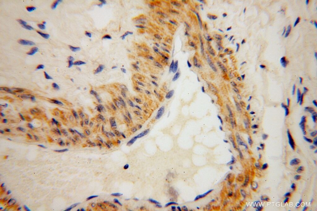 Immunohistochemistry (IHC) staining of human ovary tissue using PDLIM7 Polyclonal antibody (17080-1-AP)